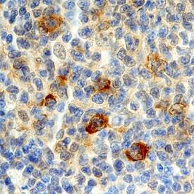 Cyclin B1 antibody in Human Lymphoma by Immunohistochemistry (IHC-P).