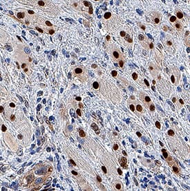 Cyclin B1 antibody in Human Squamous Cell Carcinoma by Immunohistochemistry (IHC-P).
