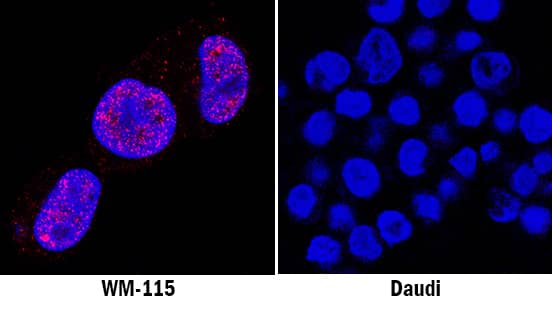 Cyclin D1 antibody in WM-115 and Daudi Human Cell Lines by Immunocytochemistry (ICC).