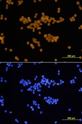 Cyclin D1 antibody in COLO 205 Human Cell Line by Immunocytochemistry (ICC).