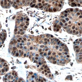 Cyclin E1 antibody in Human Breast by Immunohistochemistry (IHC-P).