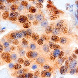 Cyclin E1 antibody in Human Breast by Immunohistochemistry (IHC-P).