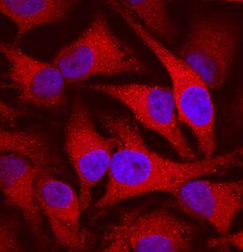 Cyclophilin B antibody in HeLa Human Cell Line by Immunocytochemistry (ICC).