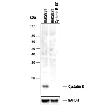 Western Blot Shows Human Cystatin B Antibody Specificity by Using Knockout Cell Line.