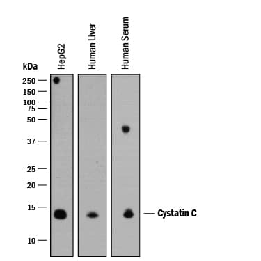 Detection of Human Cystatin C antibody by Western Blot.