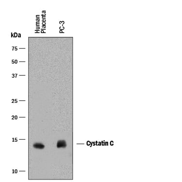 Detection of Human Cystatin C antibody by Western Blot.