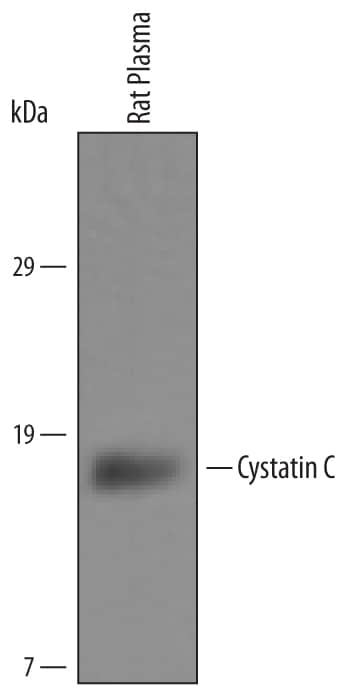 Detection of Rat Cystatin C antibody by Western Blot.