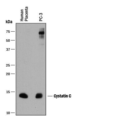 Detection of Human Cystatin C antibody by Western Blot.
