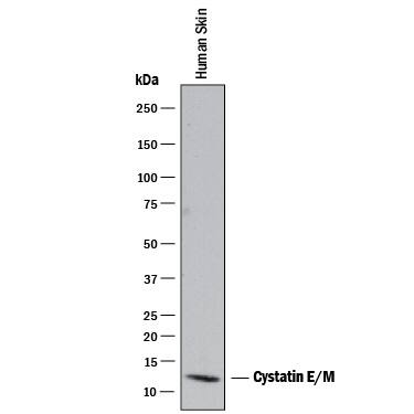 Detection of Human Cystatin E/M antibody by Western Blot.