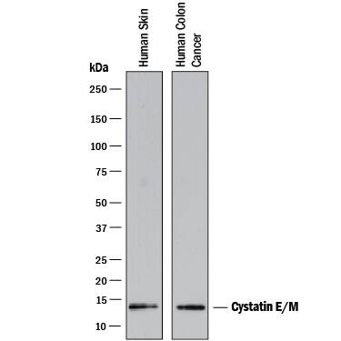 Detection of Human Cystatin E/M antibody by Western Blot.