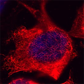 Cytokeratin 18 antibody in HeLa Human Cell Line by Immunocytochemistry (ICC).