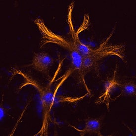 Cytokeratin 18 antibody in HeLa Human Cell Line by Immunocytochemistry (ICC).