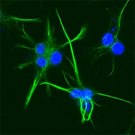 Cytokeratin 18 antibody in HeLa Human Cell Line by Immunocytochemistry (ICC).