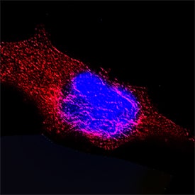 Cytokeratin 18 antibody in HeLa Human Cell Line by Immunocytochemistry (ICC).