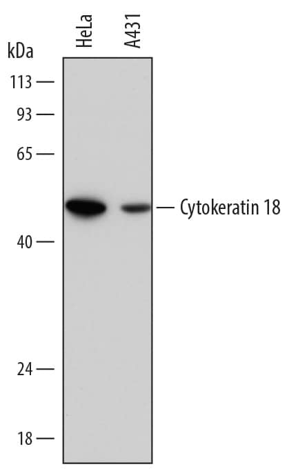 Detection of Human Cytokeratin 18 antibody by Western Blot.