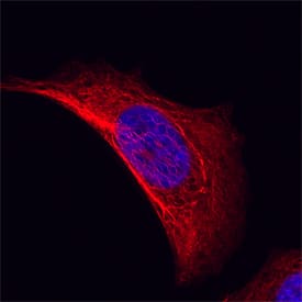 Cytokeratin 19 antibody in MCF-7 Human Cell Line by Immunocytochemistry (ICC).