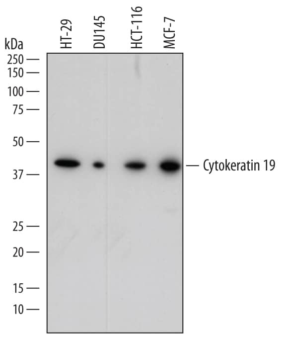 Detection of Human Cytokeratin 19 antibody by Western Blot.