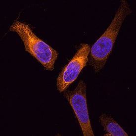 Cytokeratin 19 antibody in HeLa Human Cell Line by Immunocytochemistry (ICC).