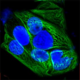 Cytokeratin 19 antibody in MCF-7 Human Cell Line by Immunocytochemistry (ICC).