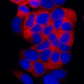 Cytokeratin 19 antibody in MCF-7 Human Cell Line by Immunocytochemistry (ICC).