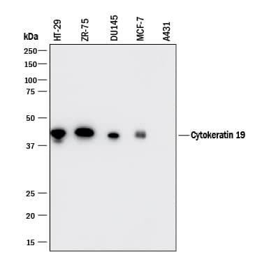 Detection of Human Cytokeratin 19 antibody by Western Blot.