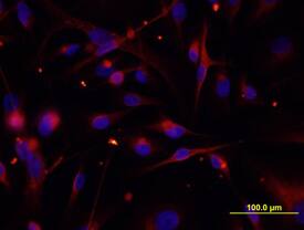 Cytokeratin 19 antibody in MDA-MB-231 Human Cell Line by Immunocytochemistry (ICC).