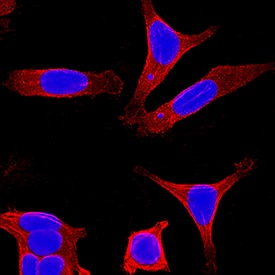 Cytokeratin 8 antibody in MCF-7 Human Cell Line by Immunocytochemistry (ICC).