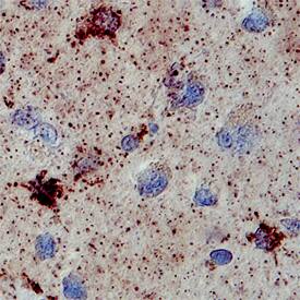 Cytosolic Sulfotransferase 1A1/SULT1A1 antibody in Human Brain by Immunohistochemistry (IHC-P).