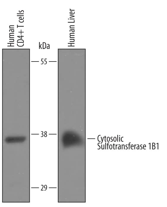 Detection of Human Cytosolic Sulfotransferase 1B1/SULT1B1 antibody by Western Blot.