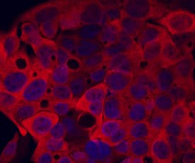 Cytosolic Sulfotransferase 2A1/SULT2A1 antibody in HepG2 Human Cell Line by Immunocytochemistry (ICC).