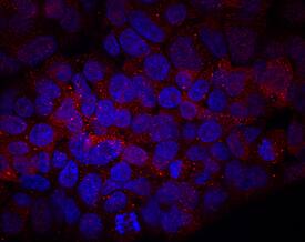 Cytosolic Sulfotransferase 2A1/SULT2A1 antibody in HepG2 Human Cell Line by Immunocytochemistry (ICC).