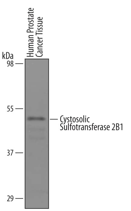 Detection of Human Cytosolic Sulfotransferase 2B1/SULT2B1 antibody by Western Blot.