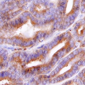 Cytosolic Sulfotransferase 2B1/SULT2B1 antibody in Human Prostate by Immunohistochemistry (IHC-P).