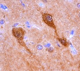 Cytosolic Sulfotransferase 4A1/SULT4A1 antibody in Human Brain by Immunohistochemistry (IHC-P).
