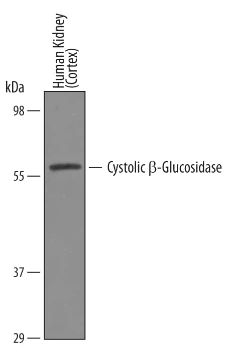 Detection of Human Cytosolic  beta-Glucosidase/GBA3 antibody by Western Blot