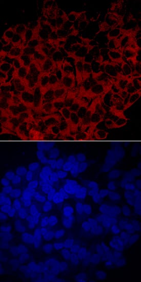 Cytosolic  beta-Glucosidase/GBA3 antibody in HeLa Human Cell Line by Immunocytochemistry (ICC).