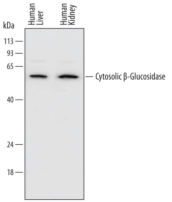 Detection of Human Cytosolic  beta-Glucosidase/GBA3 antibody by Western Blot.