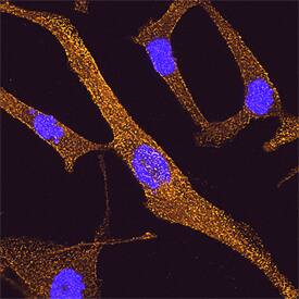 DAB2 antibody in A172 Human Cell Line by Immunocytochemistry (ICC).