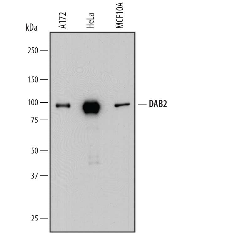 Detection of Human DAB2 antibody by Western Blot.