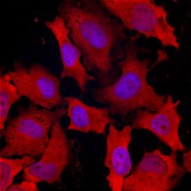 DAB2 antibody in HeLa Human Cell Line by Immunocytochemistry (ICC).
