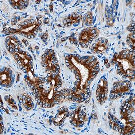 DAB2 antibody in Human Prostate by Immunohistochemistry (IHC-P).