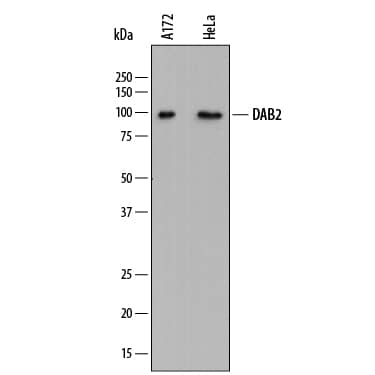 Detection of Human DAB2 antibody by Western Blot.