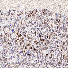 DACH2 antibody in Mouse Embryonic Brain by Immunohistochemistry (IHC-Fr).