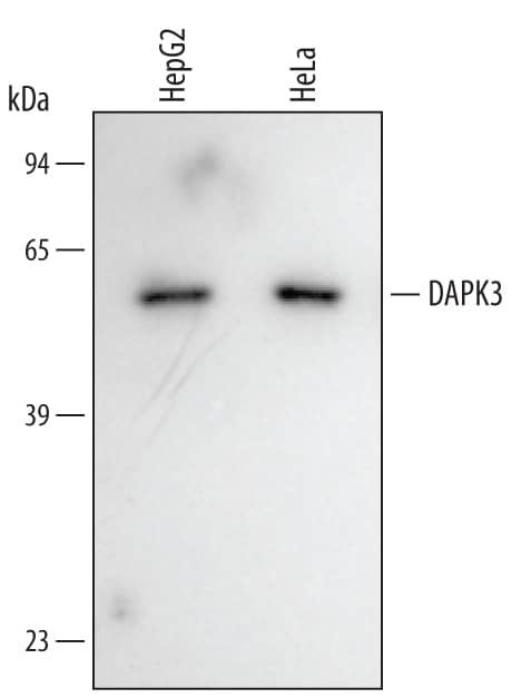 Detection of Human DAPK3/ZIPK antibody by Western Blot.