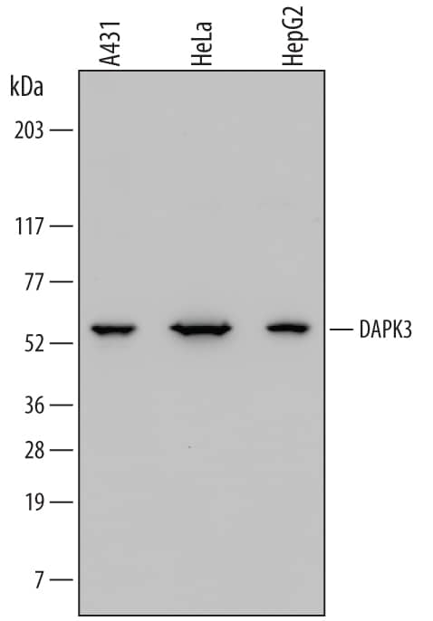 Detection of Human DAPK3/ZIPK antibody by Western Blot.