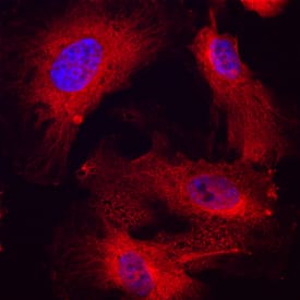 DARC antibody in Human HUVEC by Immunocytochemistry (ICC).