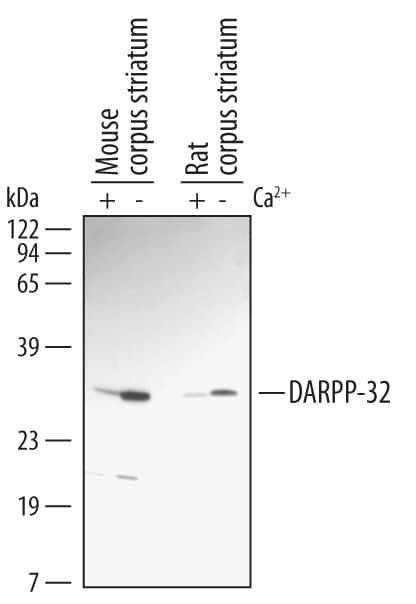 Detection of Rat and Mouse Phospho-DARPP-32 (T34) antibody by Western Blot.