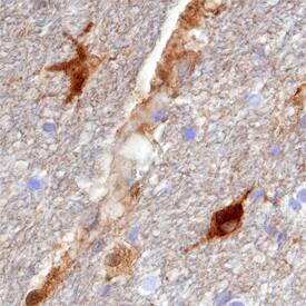 DARPP-32 antibody in Human Brain by Immunohistochemistry (IHC-P).