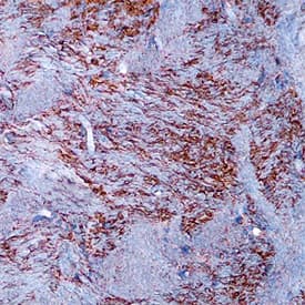 DARPP-32 antibody in Mouse Brain by Immunohistochemistry (IHC-Fr).