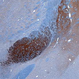 DARPP-32 antibody in Rat Brain by Immunohistochemistry (IHC-Fr).